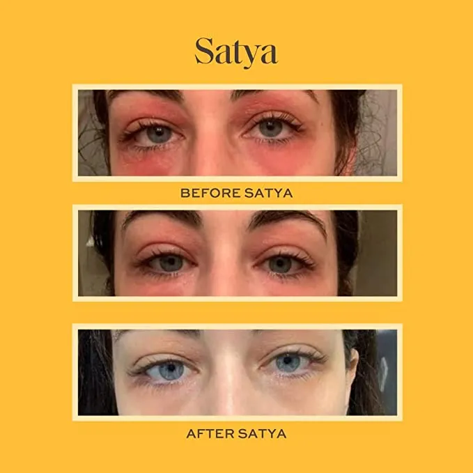 Satya Eczema Cream